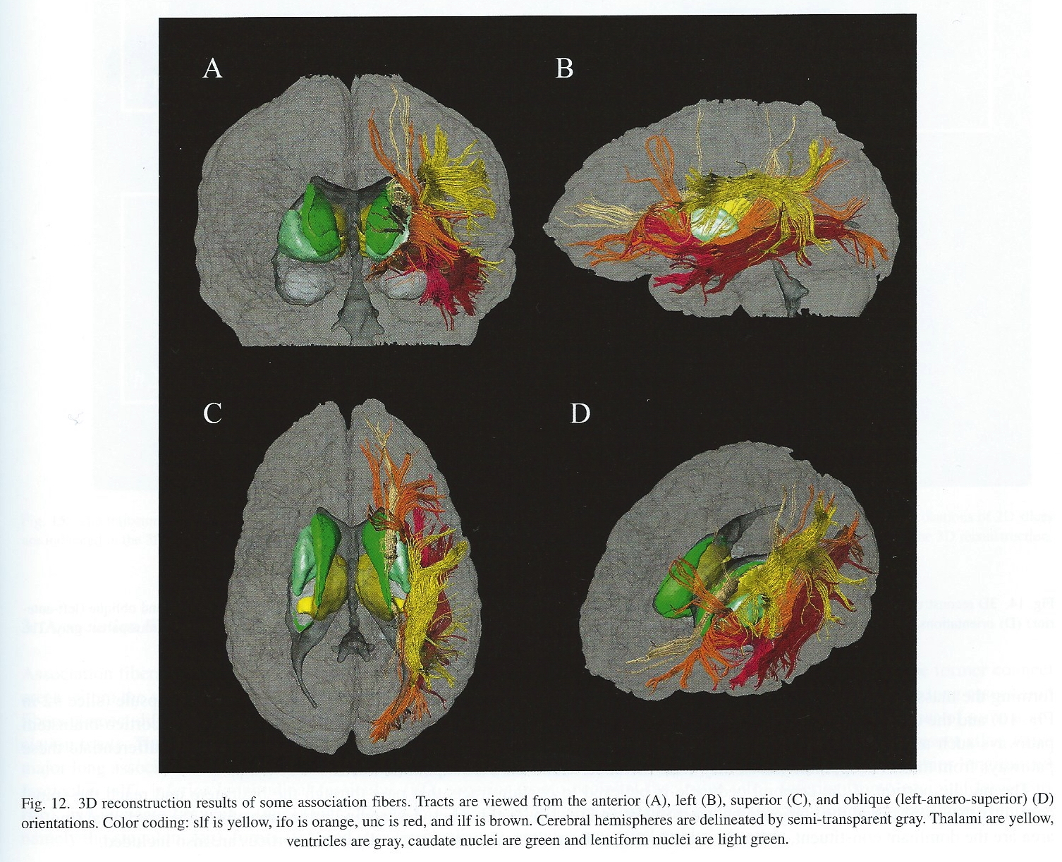 [[@oishi2010mri]](https://books.google.com/books?hl=en&lr=&id=v8MWjTpVUAYC&oi=fnd&pg=PT1&dq=mri+atlas+of+human+white+matter&ots=mV146PeNPd&sig=2HjnDc0IxdCj-EVap1Gr77XIw7U#v=onepage&q=mri%20atlas%20of%20human%20white%20matter&f=false), Chapter 3, Figure 11.