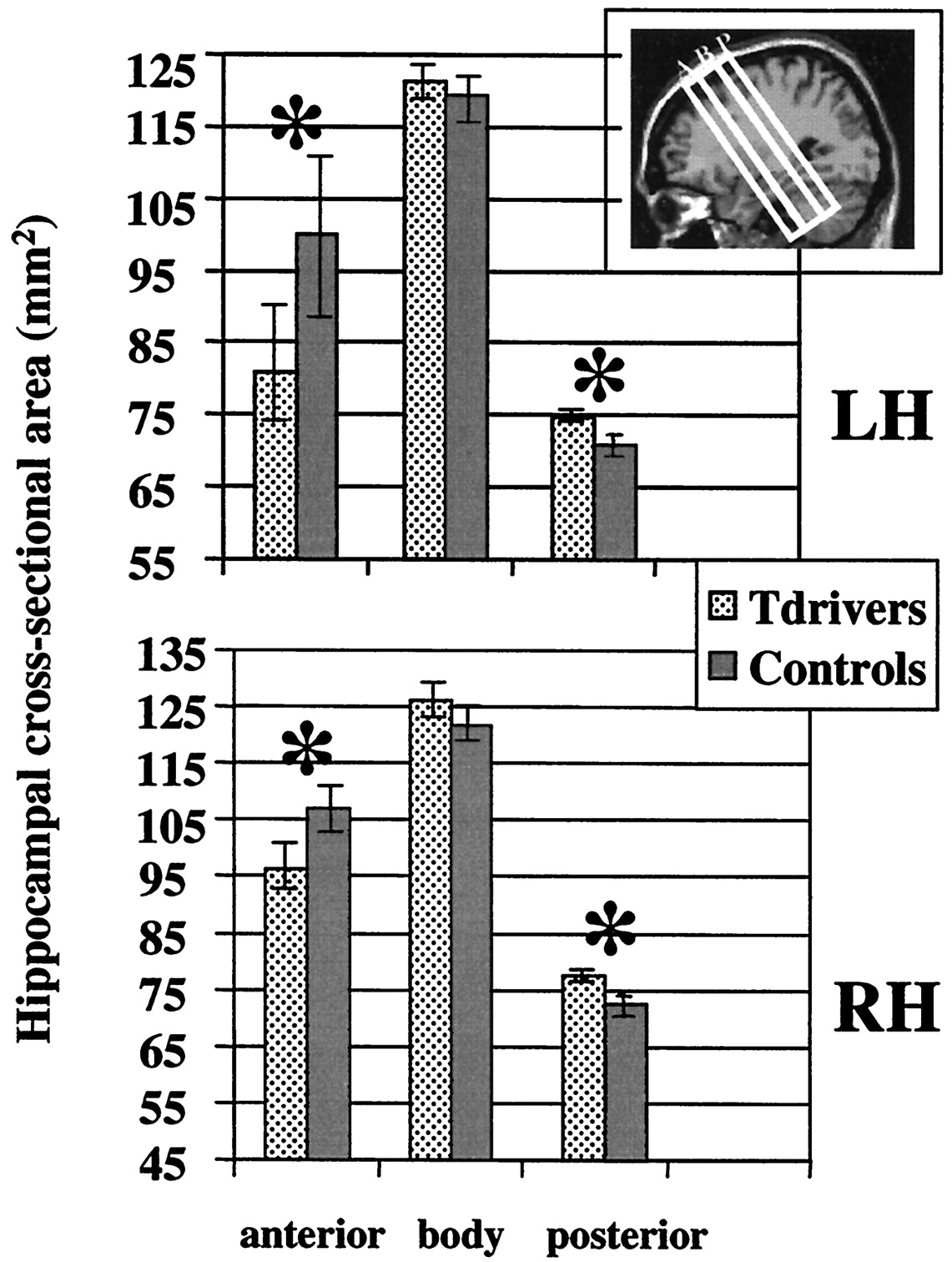 [[@maguire2000navigation]](http://dx.doi.org/10.1073/pnas.070039597)