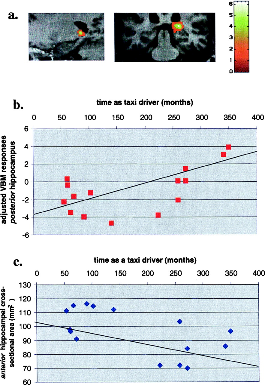 [[@maguire2000navigation]](http://dx.doi.org/10.1073/pnas.070039597)