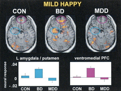 Figure from [@lawrence_subcortical_2004](http://dx.doi.org/10.1016/j.biopsych.2003.11.017)